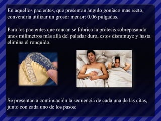 En aquellos pacientes, que presentan ángulo goníaco mas recto,
convendría utilizar un grosor menor: 0.06 pulgadas.

Para los pacientes que roncan se fabrica la prótesis sobrepasando
unos milímetros más allá del paladar duro, estos disminuye y hasta
elimina el ronquido.




Se presentan a continuación la secuencia de cada una de las citas,
junto con cada uno de los pasos:
 