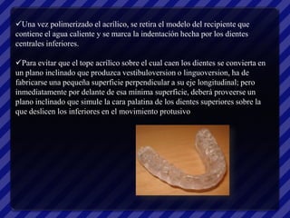 Una vez polimerizado el acrílico, se retira el modelo del recipiente que
contiene el agua caliente y se marca la indentación hecha por los dientes
centrales inferiores.

Para evitar que el tope acrílico sobre el cual caen los dientes se convierta en
un plano inclinado que produzca vestibuloversion o linguoversion, ha de
fabricarse una pequeña superficie perpendicular a su eje longitudinal; pero
inmediatamente por delante de esa mínima superficie, deberá proveerse un
plano inclinado que simule la cara palatina de los dientes superiores sobre la
que deslicen los inferiores en el movimiento protusivo
 