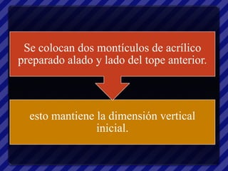 Se colocan dos montículos de acrílico
preparado alado y lado del tope anterior.



  esto mantiene la dimensión vertical
                inicial.
 