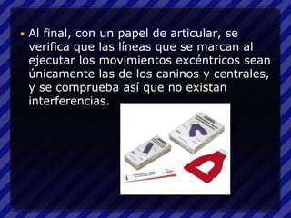    Al final, con un papel de articular, se
    verifica que las líneas que se marcan al
    ejecutar los movimientos excéntricos sean
    únicamente las de los caninos y centrales,
    y se comprueba así que no existan
    interferencias.
 