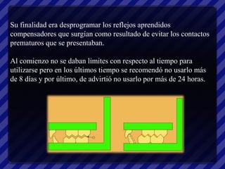 Su finalidad era desprogramar los reflejos aprendidos
compensadores que surgían como resultado de evitar los contactos
prematuros que se presentaban.

Al comienzo no se daban limites con respecto al tiempo para
utilizarse pero en los últimos tiempo se recomendó no usarlo más
de 8 días y por último, de advirtió no usarlo por más de 24 horas.
 