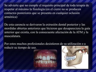 Se advierte que no cumple el requisito principal de toda terapia de
respetar al máximo la fisiología (en el cierre no se producen
contactos posteriores que se presenta en cualquier oclusión
armónica)

De esta carencia se derivaron la extrusión dental posterior y las
mordidas abiertas anteriores que hicieron que desapareciera la guía
anterior que existía, con la consecuente afectación de la ATM y la
musculatura.

Por estos muchos profesionales desistieron de su utilización o a
reducir su tiempo de uso.
 
