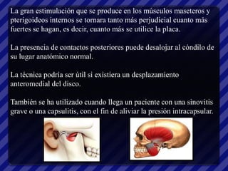La gran estimulación que se produce en los músculos maseteros y
pterigoideos internos se tornara tanto más perjudicial cuanto más
fuertes se hagan, es decir, cuanto más se utilice la placa.

La presencia de contactos posteriores puede desalojar al cóndilo de
su lugar anatómico normal.

La técnica podría ser útil si existiera un desplazamiento
anteromedial del disco.

También se ha utilizado cuando llega un paciente con una sinovitis
grave o una capsulitis, con el fin de aliviar la presión intracapsular.
 