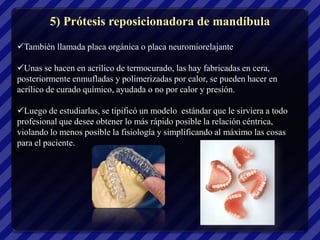 5) Prótesis reposicionadora de mandíbula
También llamada placa orgánica o placa neuromiorelajante

Unas se hacen en acrílico de termocurado, las hay fabricadas en cera,
posteriormente enmufladas y polimerizadas por calor, se pueden hacer en
acrílico de curado químico, ayudada o no por calor y presión.

Luego de estudiarlas, se tipificó un modelo estándar que le sirviera a todo
profesional que desee obtener lo más rápido posible la relación céntrica,
violando lo menos posible la fisiología y simplificando al máximo las cosas
para el paciente.
 
