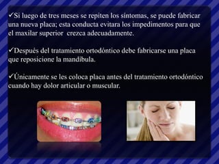 Si luego de tres meses se repiten los síntomas, se puede fabricar
una nueva placa; esta conducta evitara los impedimentos para que
el maxilar superior crezca adecuadamente.

Después del tratamiento ortodóntico debe fabricarse una placa
que reposicione la mandíbula.

Únicamente se les coloca placa antes del tratamiento ortodóntico
cuando hay dolor articular o muscular.
 