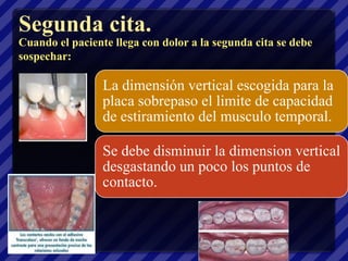 Segunda cita.
Cuando el paciente llega con dolor a la segunda cita se debe
sospechar:

                 La dimensión vertical escogida para la
                 placa sobrepaso el limite de capacidad
                 de estiramiento del musculo temporal.

                 Se debe disminuir la dimension vertical
                 desgastando un poco los puntos de
                 contacto.
 