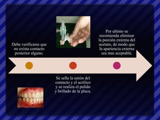 Por ultimo se
                                                  recomienda eliminar
                                                 la porción externa del
Debe verificarse que                             acetato, de modo que
 no exista contacto                               la apariencia externa
 posterior alguno.                                 sea mas aceptable.




                        Se sella la unión del
                       contacto y el acrílico
                       y se realiza el pulido
                       y brillado de la placa.
 