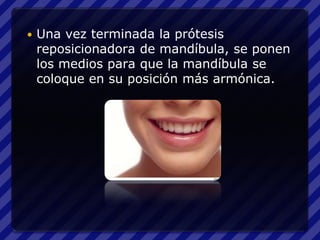    Una vez terminada la prótesis
    reposicionadora de mandíbula, se ponen
    los medios para que la mandíbula se
    coloque en su posición más armónica.
 