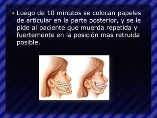    Luego de 10 minutos se colocan papeles
    de articular en la parte posterior, y se le
    pide al paciente que muerda repetida y
    fuertemente en la posición mas retruida
    posible.
 