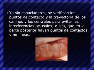    Ya sin espaciadores, se verifican los
    puntos de contacto y la trayectoria de los
    caninos y los centrales para evitar las
    interferencias oclusales; o sea, que en la
    parte posterior hayan puntos de contactos
    y no líneas.
 