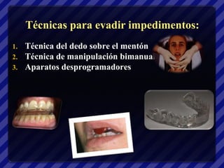Técnicas para evadir impedimentos:
1.   Técnica del dedo sobre el mentón
2.   Técnica de manipulación bimanual
3.   Aparatos desprogramadores
 
