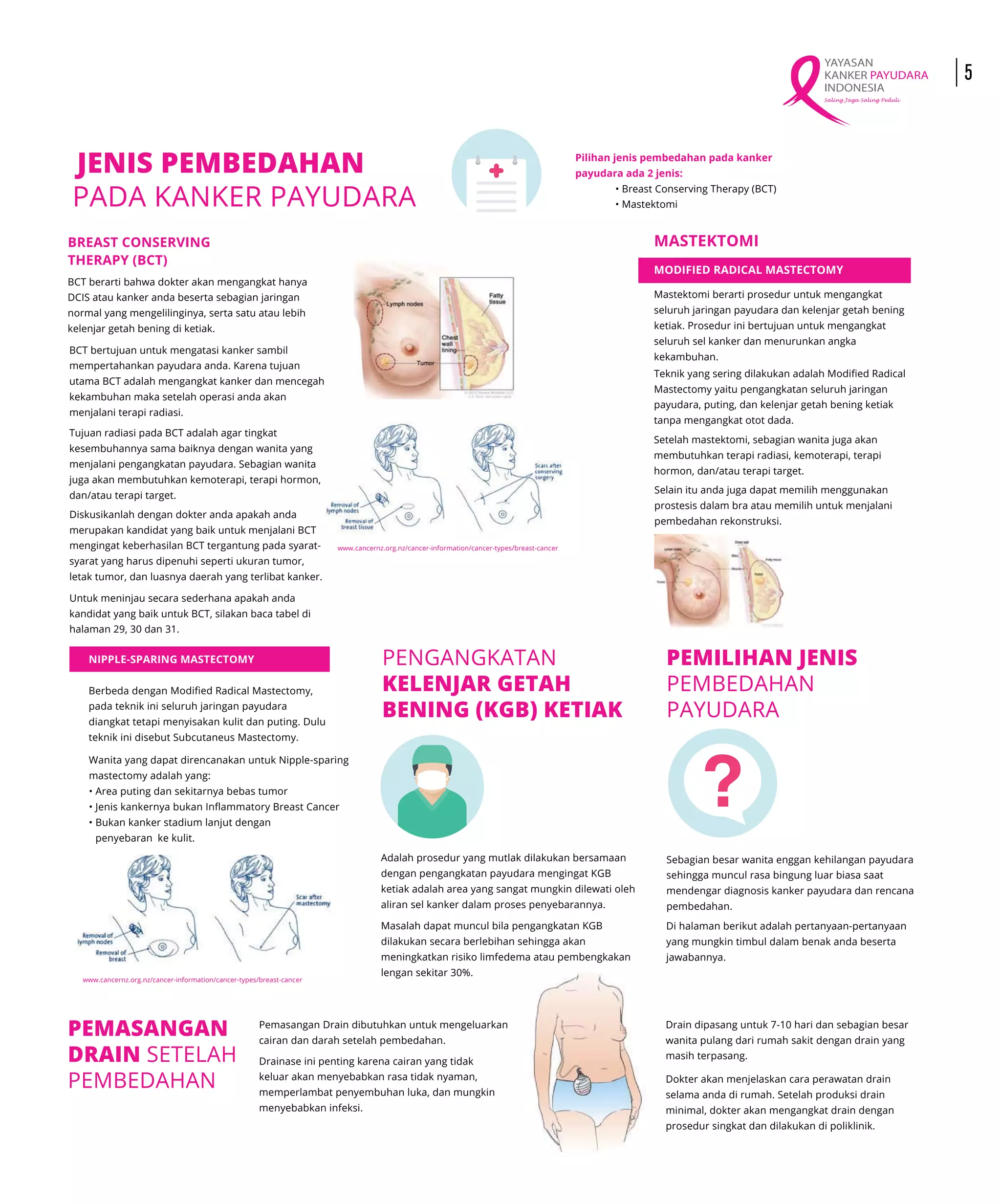 Terapi Bedah Kanker Payudara PDF