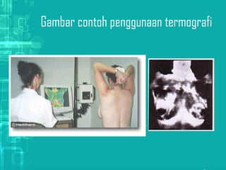 Gambar contoh penggunaan termografi
 