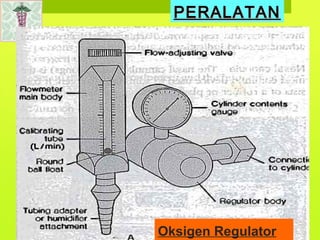 Oksigen Regulator
PERALATANPERALATAN
 