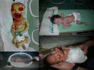 Teratógenos fisico-quimicos