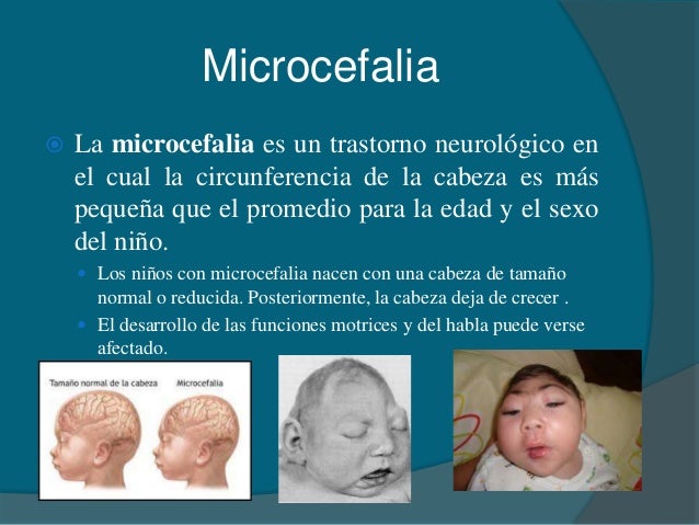 La corrección del pecho en tveri