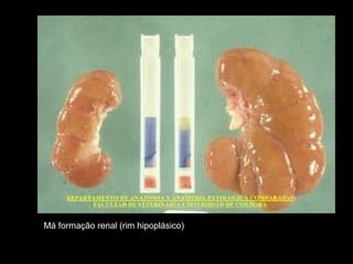 Má formação renal (rim hipoplásico)
 
