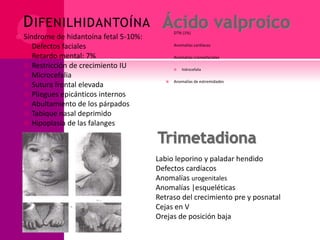 DIFENILHIDANTOÍNA
 Síndrome de hidantoína fetal 5-10%:
 Defectos faciales
 Retardo mental: 7%
 Restricción de crecimiento IU
 Microcefalia
 Sutura frontal elevada
 Pliegues epicánticos internos
 Abultamiento de los párpados
 Tabique nasal deprimido
 Hipoplasia de las falanges
 DTN (1%)
 Anomalías cardíacas
 Anomalías craneofaciales
 hidrocefalia
 Anomalías de extremidades
Labio leporino y paladar hendido
Defectos cardíacos
Anomalías urogenitales
Anomalías |esqueléticas
Retraso del crecimiento pre y posnatal
Cejas en V
Orejas de posición baja
 