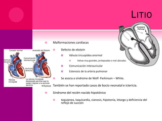 LITIO
 Malformaciones cardíacas
 Defecto de ebstein
 Válvula tricuspídea anormal
 Valvas muy grandes, prolapsadas o mal ubicadas
 Comunicación interauricular
 Estenosis de la arteria pulmonar
 Se asocia a síndrome de Wolf- Parkinson – White.
 También se han reportado casos de bocio neonatal e ictericia.
 Síndrome del recién nacido hipotónico
 taquipnea, taquicardia, cianosis, hipotonía, letargo y deficiencia del
reflejo de succión
 