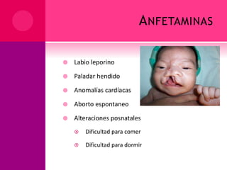 ANFETAMINAS
 Labio leporino
 Paladar hendido
 Anomalías cardíacas
 Aborto espontaneo
 Alteraciones posnatales
 Dificultad para comer
 Dificultad para dormir
 