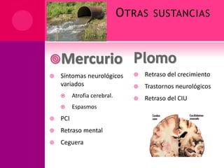OTRAS SUSTANCIAS
 Síntomas neurológicos
variados
 Atrofia cerebral.
 Espasmos
 PCI
 Retraso mental
 Ceguera
 Retraso del crecimiento
 Trastornos neurológicos
 Retraso del CIU
 