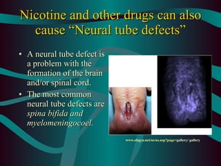is tobacco a teratogen as Tobacco use in currently married pregnant & lactating women in India; key Prenatal Tobacco Exposure and Brain