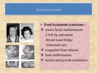 • Fetal hydantoin syndrome :
 cranio facial malformation:
-Cleft lip and palate
-Broad nasal bridge
-Abnormal ears
 congenital heart disease
 limb malformation
 mental and growth retardation
 
