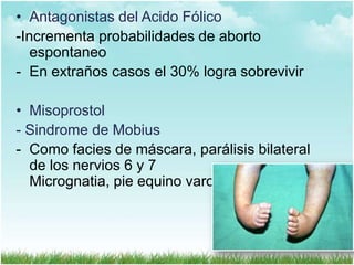 • Antagonistas del Acido Fólico
-Incrementa probabilidades de aborto
espontaneo
- En extraños casos el 30% logra sobrevivir
• Misoprostol
- Sindrome de Mobius
- Como facies de máscara, parálisis bilateral
de los nervios 6 y 7
Micrognatia, pie equino varo

 