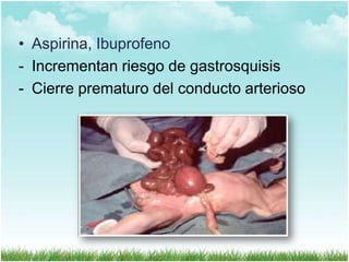 • Aspirina, Ibuprofeno
- Incrementan riesgo de gastrosquisis
- Cierre prematuro del conducto arterioso

 