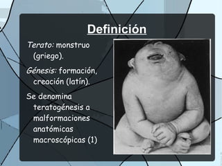 Definición
Terato: monstruo
 (griego).
Génesis: formación,
 creación (latín).
Se denomina
 teratogénesis a
 malformaciones
 anatómicas
 macroscópicas (1)
 