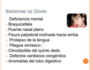 SÍNDROME DE DOWN
 Deficiencia mental
 Braquicefalia
 Puente nasal plano
 Fisura palpebral inclinada hacia arriba
 Prolapso de la lengua
 Pliegue simiesco
 Clinodactilia del quinto dedo
 Defectos cardiacos congénitos
 Anomalías del tubo digestivo
 