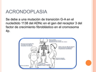 ACRONDOPLASIA
Se debe a una mutación de transición G-A en el
nucleótido 1138 del ADNc en el gen del receptor 3 del
factor de crecimiento fibroblástico en el cromosoma
4p.
 