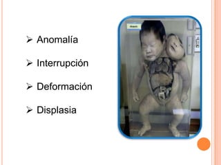 Anomalía

 Interrupción

 Deformación

 Displasia
 