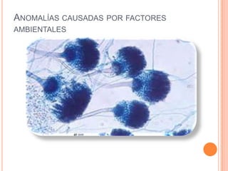 ANOMALÍAS CAUSADAS POR FACTORES
AMBIENTALES
 