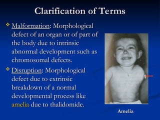 Year 1 Med School Teratology Slides Learning | PPT