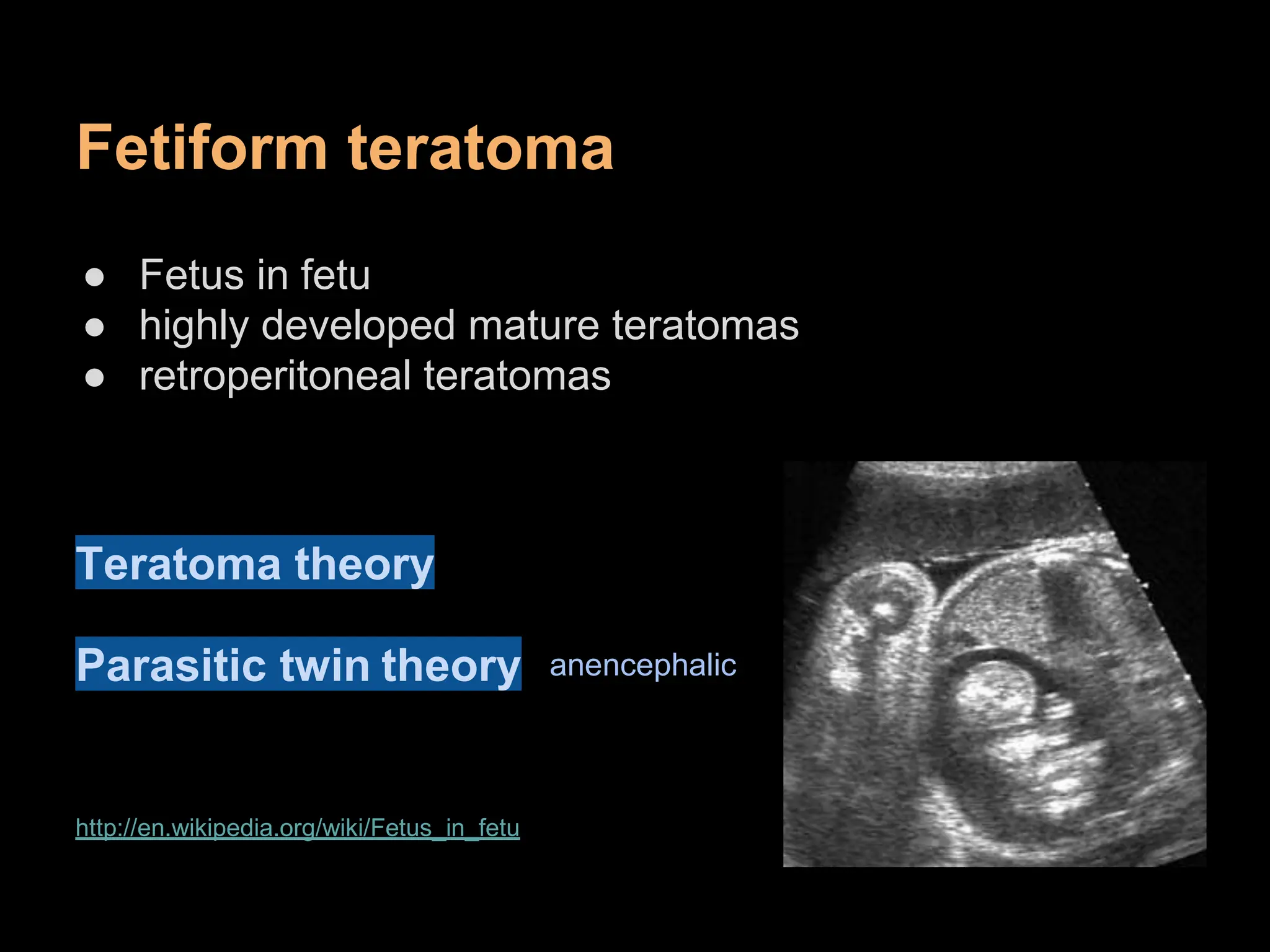 Toratoscomia teratoma-150429041338-conversion-gate01.docx | Pregnancy | Reproductive ...