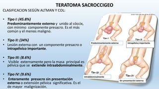 Teratoma | PPTX