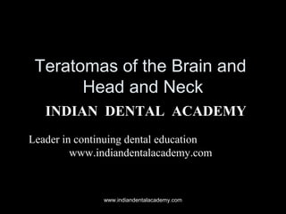Teratomas of the Brain and
Head and Neck
INDIAN DENTAL ACADEMY
Leader in continuing dental education
www.indiandentalacademy.com

www.indiandentalacademy.com

 