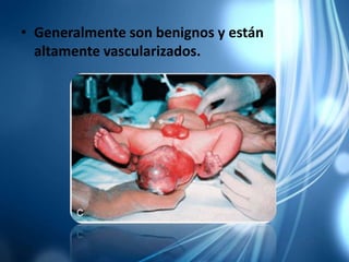 • Generalmente son benignos y están
altamente vascularizados.
 