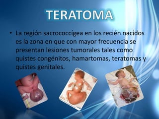 • La región sacrococcígea en los recién nacidos
es la zona en que con mayor frecuencia se
presentan lesiones tumorales tales como
quistes congénitos, hamartomas, teratomas y
quistes genitales.
 
