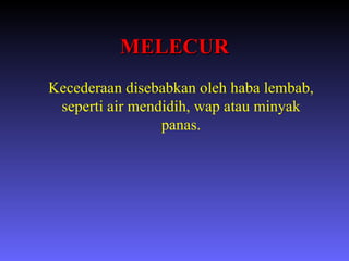 MELECUR Kecederaan disebabkan oleh haba lembab, seperti air mendidih, wap atau minyak panas. 
