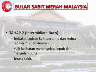 TAHAP 2 (Intermidiate Burn) Terbakar lapisan kulit pertama dan kedua (epidermis dan dermis). Kulit kelihatan merah gelap, lepuh dan mengelembung. Terasa sakit. 