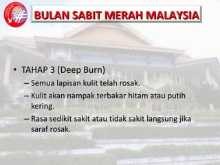 TAHAP 3 (Deep Burn) Semua lapisan kulit telah rosak. Kulit akan nampak terbakar hitam atau putih kering. Rasa sedikit sakit atau tidak sakit langsung jika saraf rosak. 