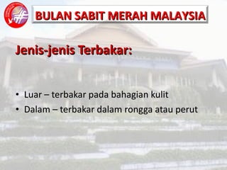 Jenis-jenis Terbakar: Luar – terbakar pada bahagian kulit Dalam – terbakar dalam rongga atau perut 