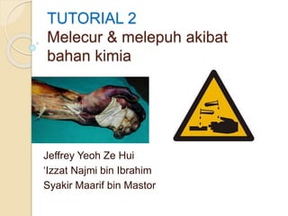 TUTORIAL 2
Melecur & melepuh akibat
bahan kimia
Jeffrey Yeoh Ze Hui
‘Izzat Najmi bin Ibrahim
Syakir Maarif bin Mastor
 