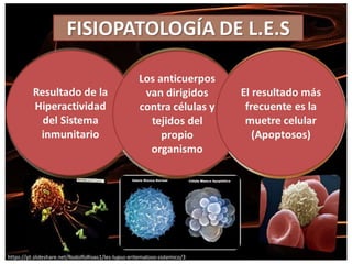 https://pt.slideshare.net/RodolfoRivas1/les-lupus-eritematoso-sistemico/3
 