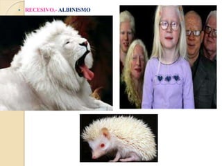  RECESIVO.- ALBINISMO
 