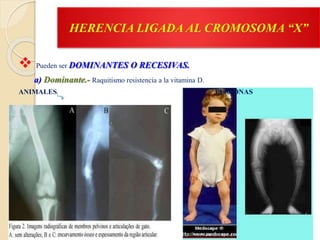 HERENCIA LIGADA AL CROMOSOMA “X”
 Pueden ser DOMINANTES O RECESIVAS.
a) Dominante.- Raquitismo resistencia a la vitamina D.
ANIMALES PERSONAS
 