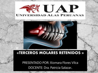 «TERCEROS MOLARES RETENIDOS »
PRESENTADO POR: Xiomara Flores Vilca
DOCENTE: Dra. Patricia Salazar.
 