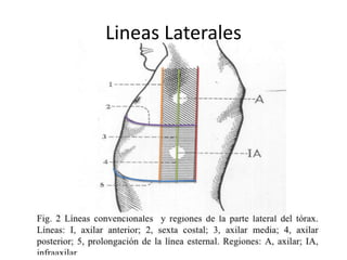 Lineas Laterales
 
